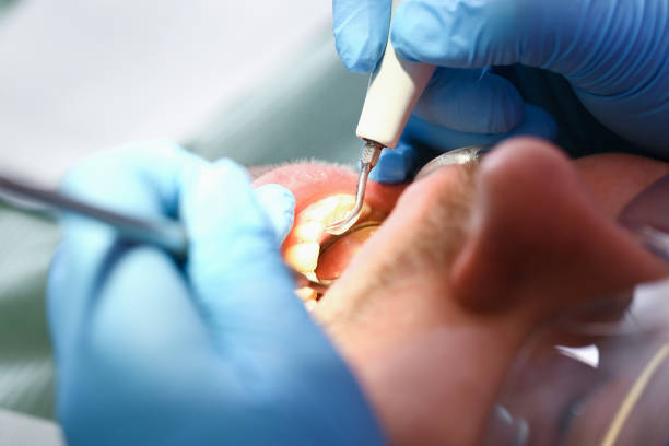 Best Emergency Care for Gum Disease in Chestnut Ridge, NY