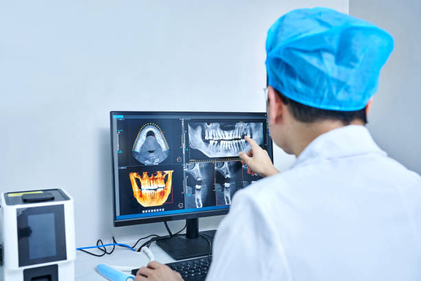 Best Emergency Dental Care for Sports Injuries in Chestnut Ridge, NY