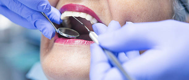 Best Dental Abscess Treatment in Chestnut Ridge, NY